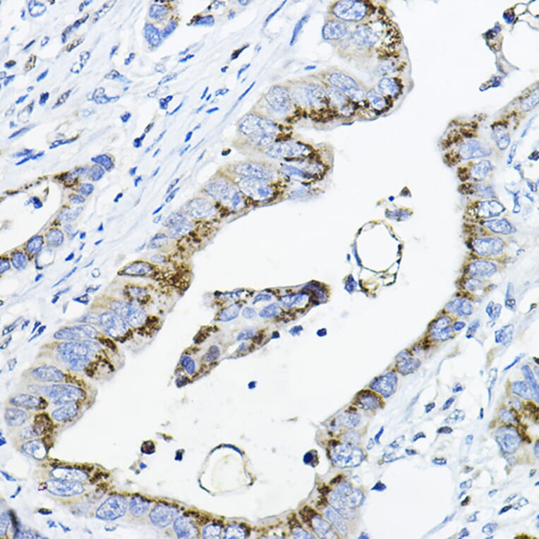 Immunohistochemistry - Anti-GALNT3 Antibody (A91063) - Antibodies.com