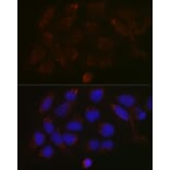 Immunofluorescence - Anti-GALNT3 Antibody (A91063) - Antibodies.com