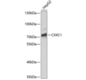 Western Blot - Anti-CGBP Antibody (A91064) - Antibodies.com