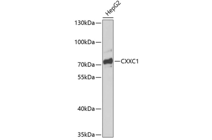 Western Blot - Anti-CGBP Antibody (A91064) - Antibodies.com