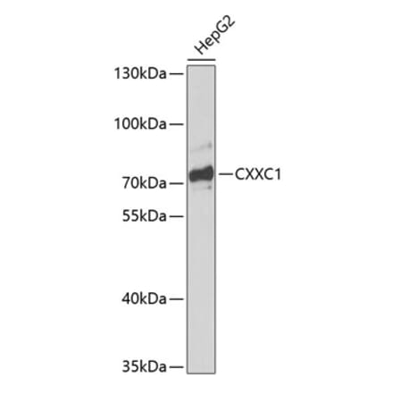 Western Blot - Anti-CGBP Antibody (A91064) - Antibodies.com