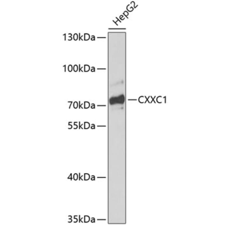 Western Blot - Anti-CGBP Antibody (A91064) - Antibodies.com