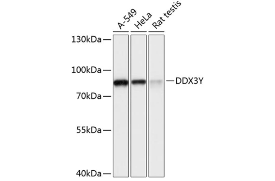 Western Blot - Anti-DDX3Y Antibody (A91065) - Antibodies.com