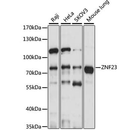 Western Blot - Anti-ZNF23 Antibody (A91066) - Antibodies.com
