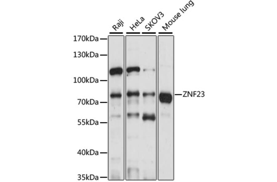 Western Blot - Anti-ZNF23 Antibody (A91066) - Antibodies.com