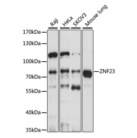 Western Blot - Anti-ZNF23 Antibody (A91066) - Antibodies.com