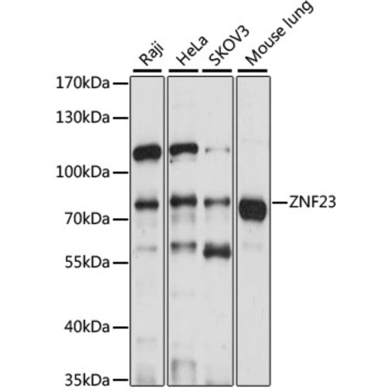 Western Blot - Anti-ZNF23 Antibody (A91066) - Antibodies.com
