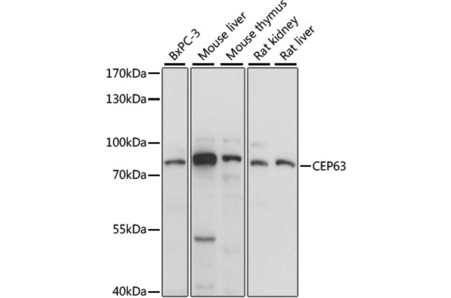 Western Blot - Anti-CEP63 Antibody (A91067) - Antibodies.com