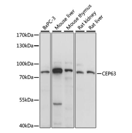 Western Blot - Anti-CEP63 Antibody (A91067) - Antibodies.com