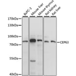 Western Blot - Anti-CEP63 Antibody (A91067) - Antibodies.com