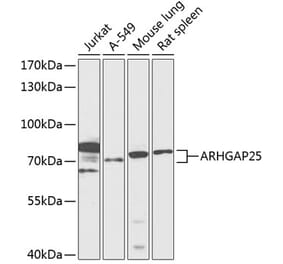 Western Blot - Anti-ARHGAP25 Antibody (A91068) - Antibodies.com