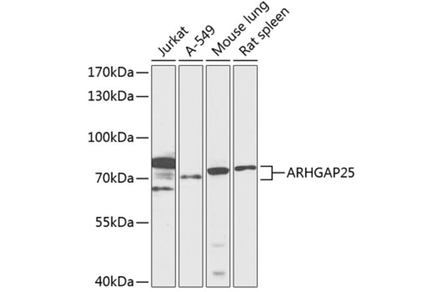 Western Blot - Anti-ARHGAP25 Antibody (A91068) - Antibodies.com