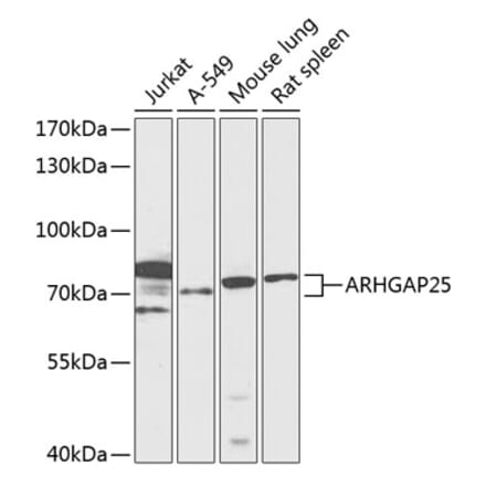 Western Blot - Anti-ARHGAP25 Antibody (A91068) - Antibodies.com