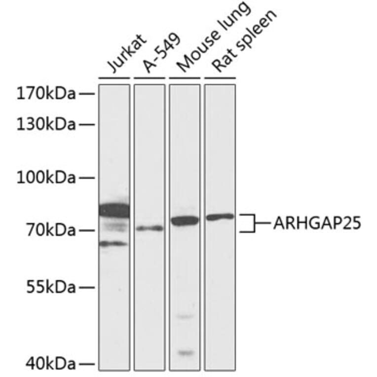 Western Blot - Anti-ARHGAP25 Antibody (A91068) - Antibodies.com