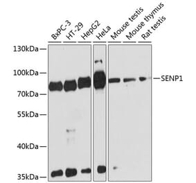 Western Blot - Anti-SENP1 Antibody (A91069) - Antibodies.com