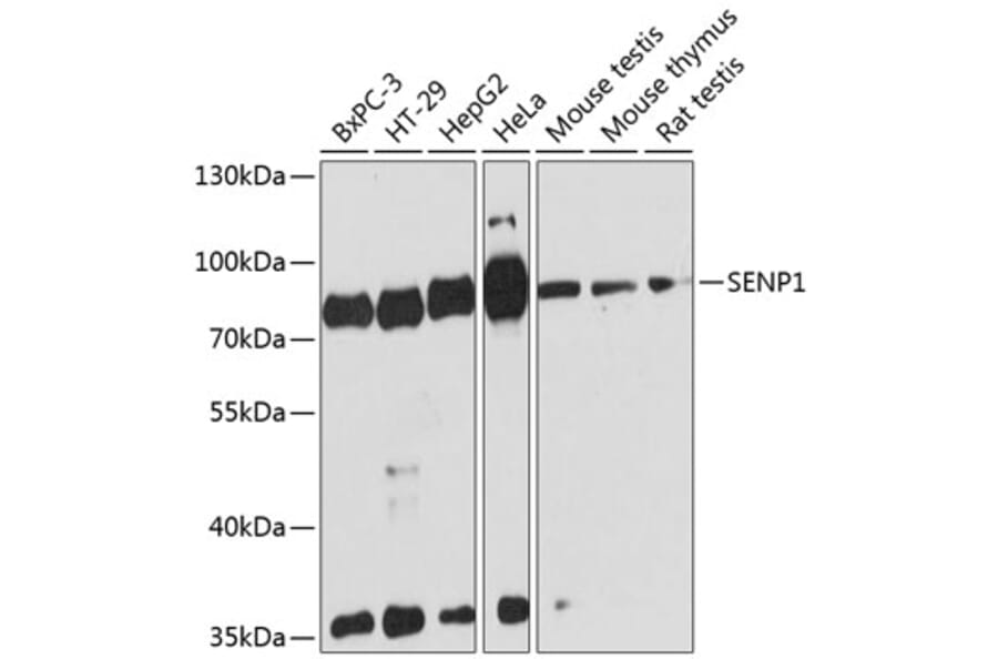 Western Blot - Anti-SENP1 Antibody (A91069) - Antibodies.com