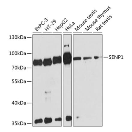 Western Blot - Anti-SENP1 Antibody (A91069) - Antibodies.com
