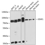 Western Blot - Anti-SENP1 Antibody (A91069) - Antibodies.com
