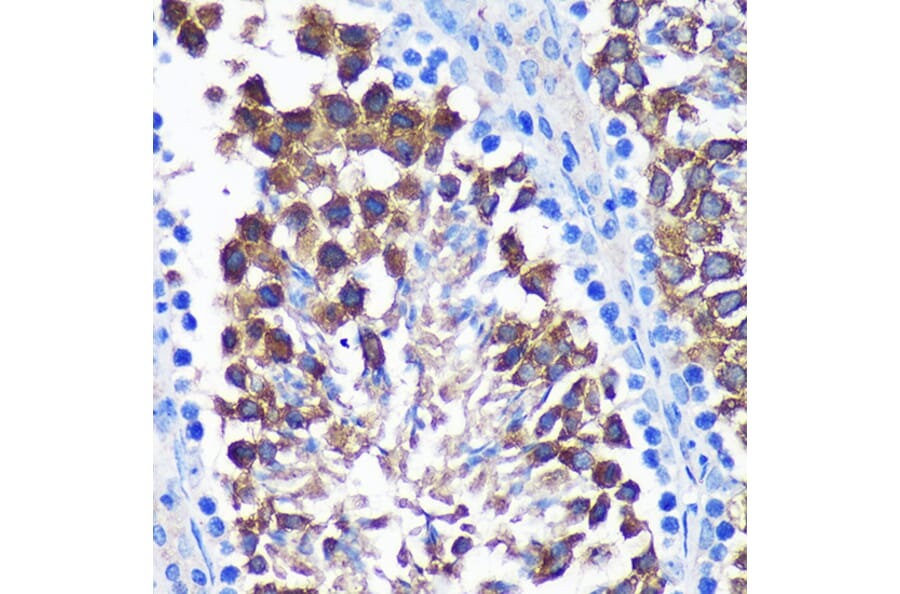 Immunohistochemistry - Anti-SENP1 Antibody (A91069) - Antibodies.com