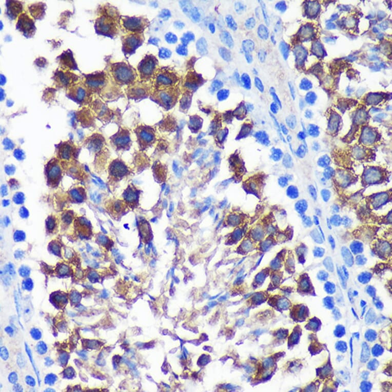 Immunohistochemistry - Anti-SENP1 Antibody (A91069) - Antibodies.com
