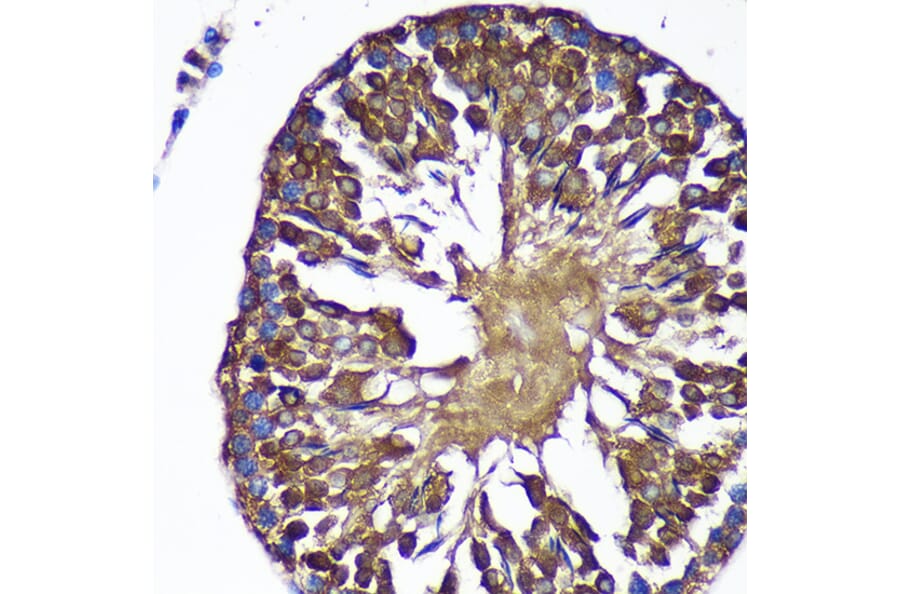 Immunohistochemistry - Anti-SENP1 Antibody (A91069) - Antibodies.com