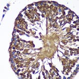Immunohistochemistry - Anti-SENP1 Antibody (A91069) - Antibodies.com