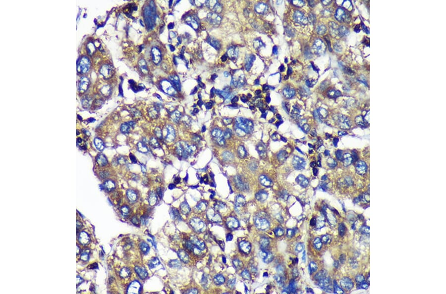 Immunohistochemistry - Anti-SENP1 Antibody (A91069) - Antibodies.com
