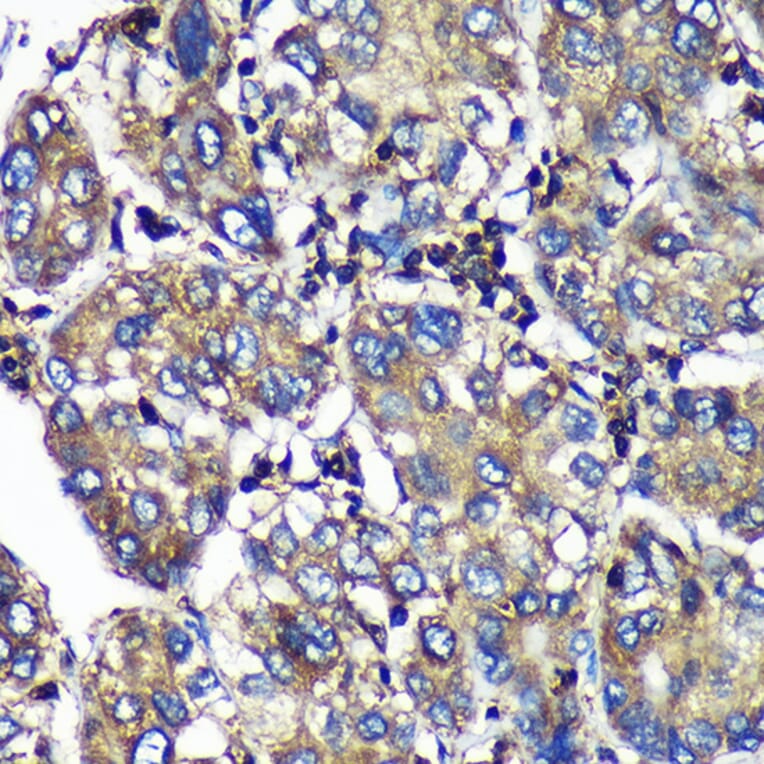 Immunohistochemistry - Anti-SENP1 Antibody (A91069) - Antibodies.com