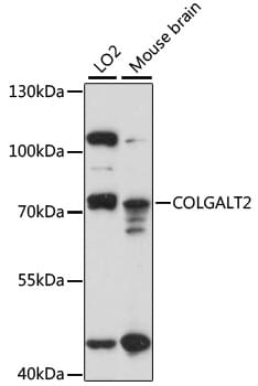 Western blot analysis of extracts of various cell lines, using Anti-COLGALT2 Antibody (A15407) at 1:1,000 dilution.
Secondary antibody: Goat Anti-Rabbit IgG (H+L) (HRP) (AS014) at 1:10,000 dilution.
Lysates / proteins: 25µg per lane.
Blocking buffer: 3% non-fat dry milk in TBST.
Detection: ECL Basic Kit (RM00020).
Exposure time: 30s.