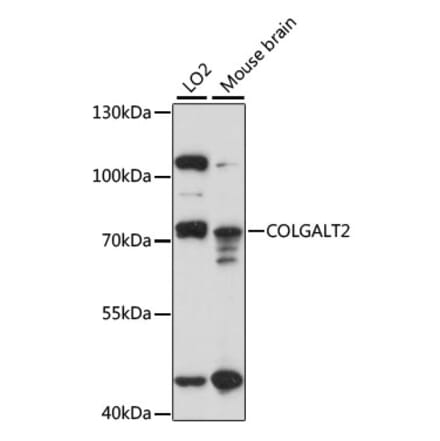 Western Blot - Anti-GLT25D2 Antibody (A91070) - Antibodies.com