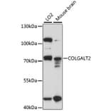 Western Blot - Anti-GLT25D2 Antibody (A91070) - Antibodies.com