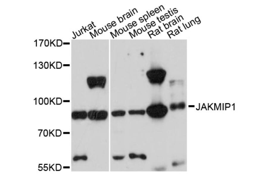 Western Blot - Anti-JAKMIP1 Antibody (A13774) - Antibodies.com