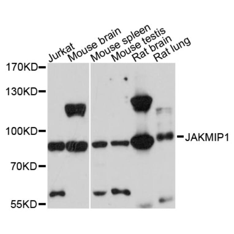 Western Blot - Anti-JAKMIP1 Antibody (A13774) - Antibodies.com