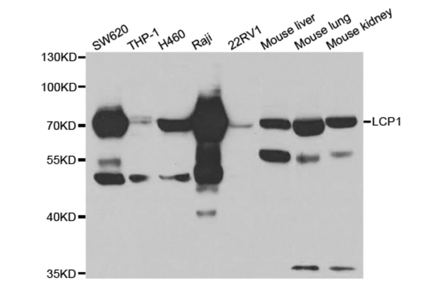 Western Blot - Anti-LCP1 Antibody (A13504) - Antibodies.com