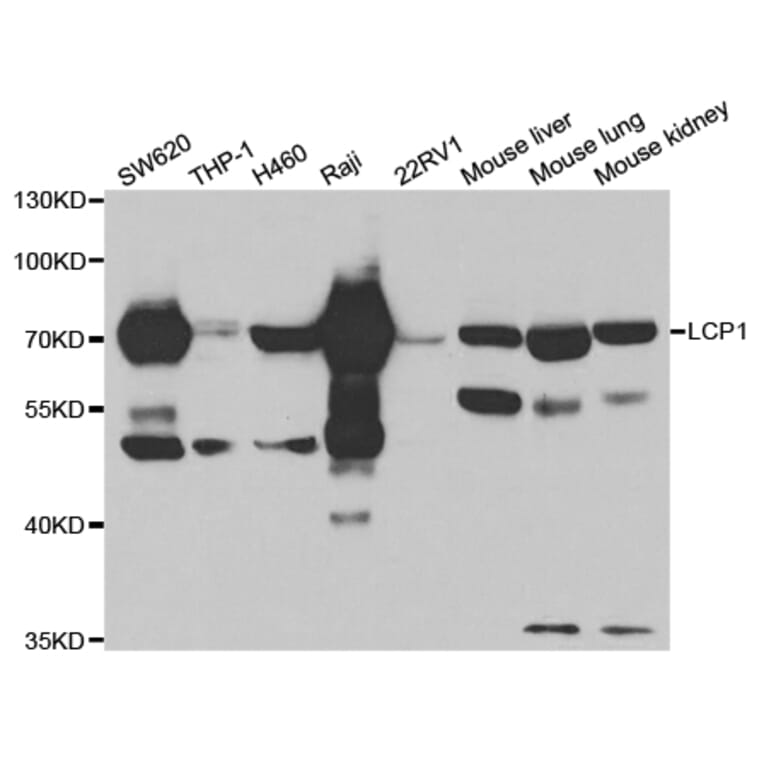 Western Blot - Anti-LCP1 Antibody (A13504) - Antibodies.com