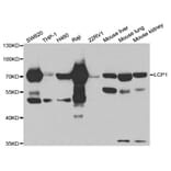 Western Blot - Anti-LCP1 Antibody (A13504) - Antibodies.com