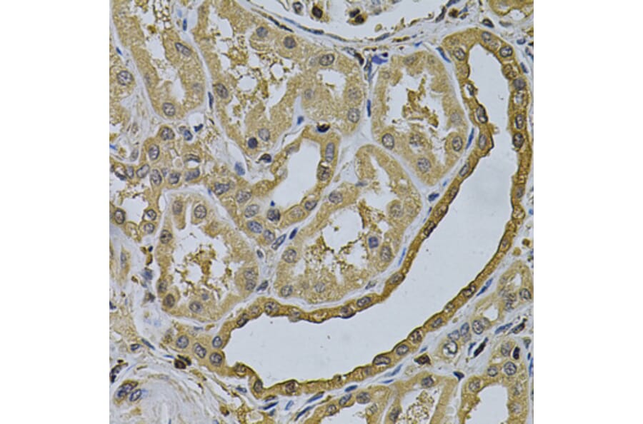 Immunohistochemistry - Anti-LCP1 Antibody (A13504) - Antibodies.com