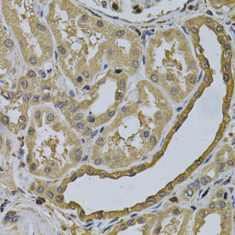 Immunohistochemistry - Anti-LCP1 Antibody (A13504) - Antibodies.com