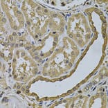 Immunohistochemistry - Anti-LCP1 Antibody (A13504) - Antibodies.com