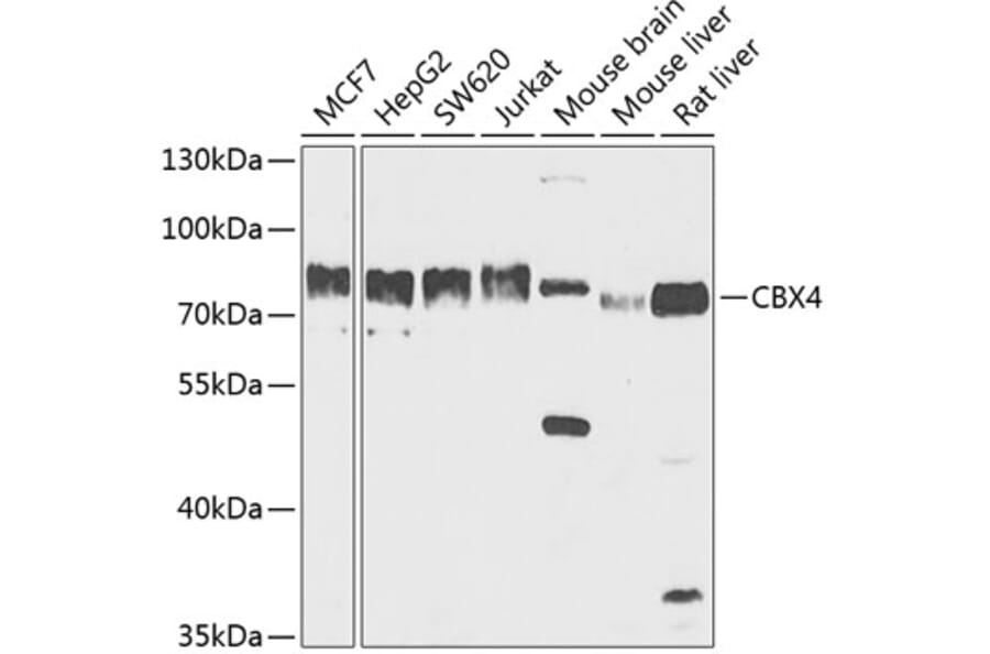 Western Blot - Anti-CBX4 Antibody (A91075) - Antibodies.com