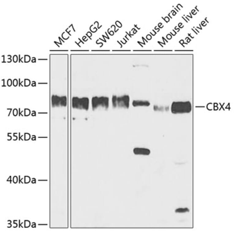 Western Blot - Anti-CBX4 Antibody (A91075) - Antibodies.com