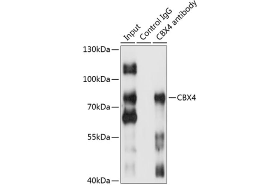 Western Blot - Anti-CBX4 Antibody (A91075) - Antibodies.com