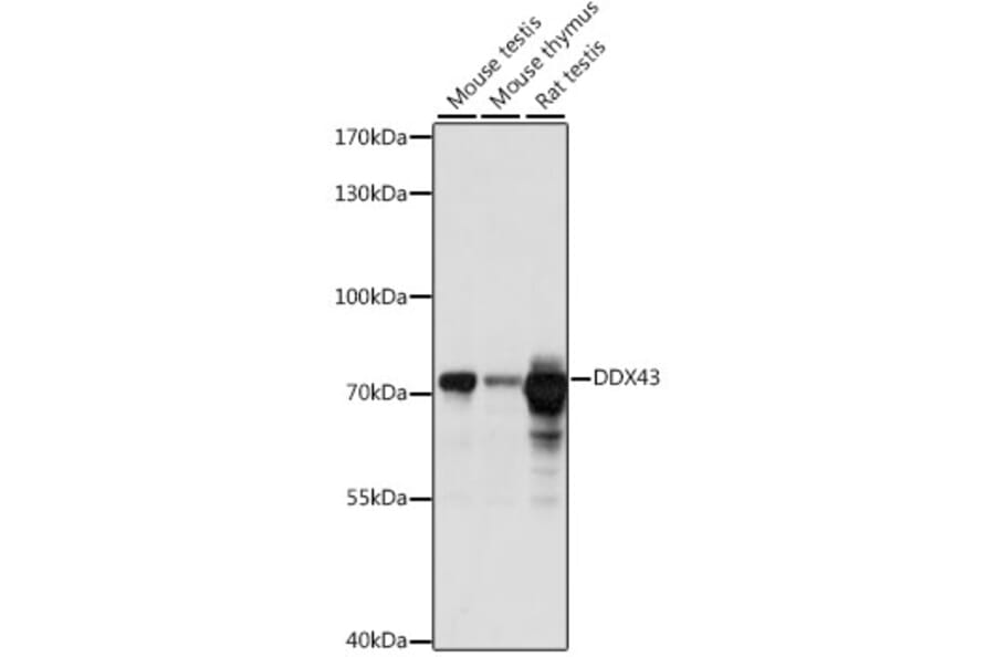Western Blot - Anti-HAGE Antibody (A91076) - Antibodies.com