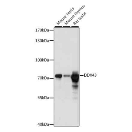 Western Blot - Anti-HAGE Antibody (A91076) - Antibodies.com