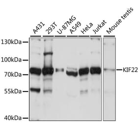 Western Blot - Anti-KIF22 Antibody (A91079) - Antibodies.com