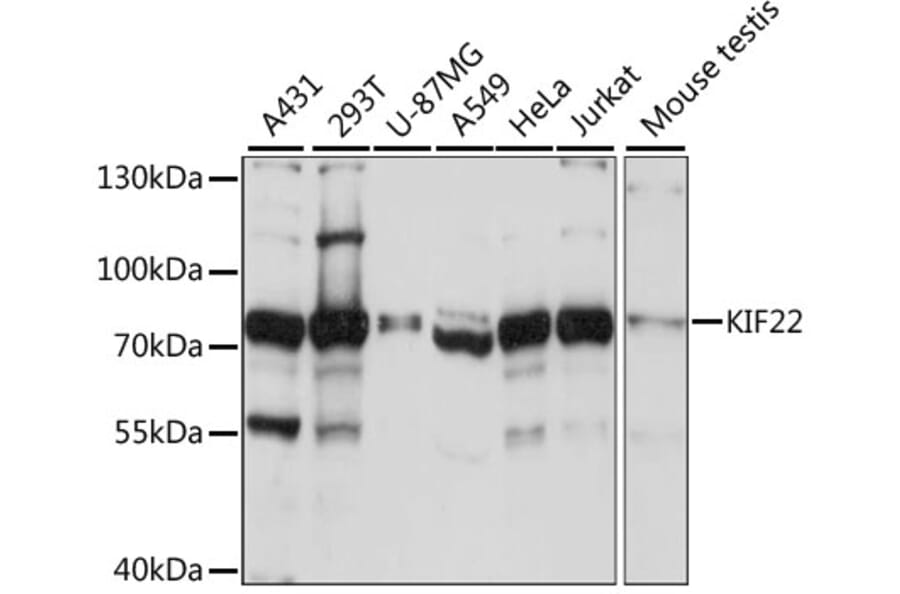 Western Blot - Anti-KIF22 Antibody (A91079) - Antibodies.com