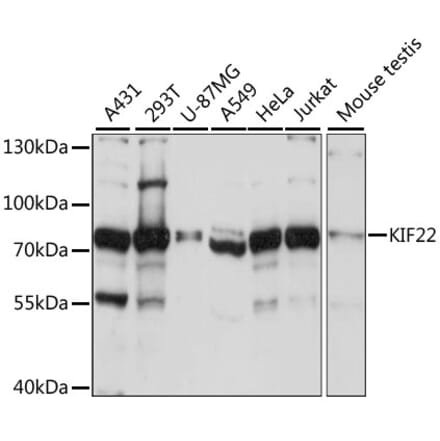 Western Blot - Anti-KIF22 Antibody (A91079) - Antibodies.com