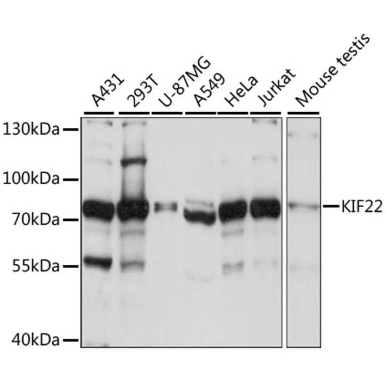 Western Blot - Anti-KIF22 Antibody (A91079) - Antibodies.com