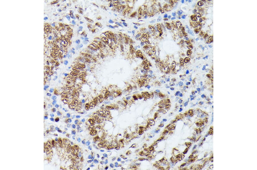 Immunohistochemistry - Anti-KIF22 Antibody (A91079) - Antibodies.com