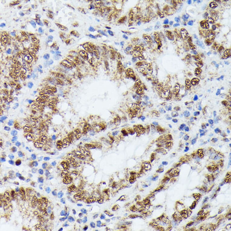 Immunohistochemistry - Anti-KIF22 Antibody (A91079) - Antibodies.com